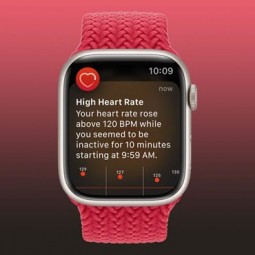 Một phụ nữ được cứu sống nhờ đeo Apple Watch