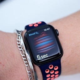 Apple Watch sẽ có đo huyết áp, nhiệt độ